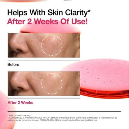 ANUA Niacinamide 10% + TXA 4% Serum
